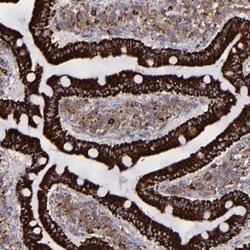 Monoamine Oxidase B Antibody, Novus Biologicals 0.1mL; Unlabeled:Antibodies,