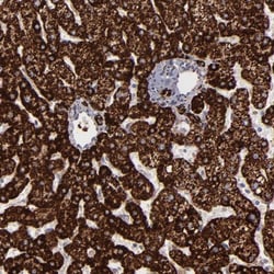 Monoamine Oxidase B Antibody, Novus Biologicals 0.1mL; Unlabeled:Antibodies,