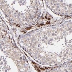 Monoamine Oxidase B Antibody, Novus Biologicals 0.1mL; Unlabeled:Antibodies,