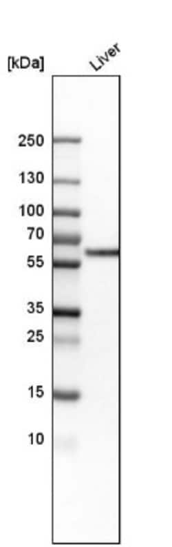 Monoamine Oxidase B Antibody, Novus Biologicals 0.1mL; Unlabeled:Antibodies,