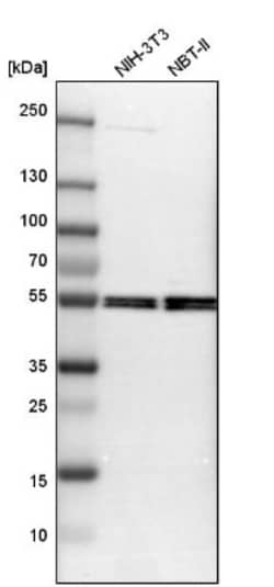 Monoamine Oxidase B Antibody, Novus Biologicals 0.1mL; Unlabeled:Antibodies,