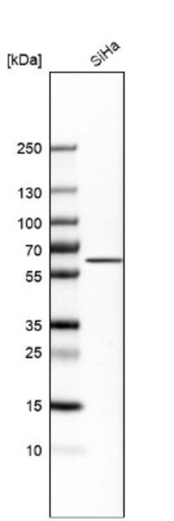 Monoamine Oxidase B Antibody, Novus Biologicals 0.1mL; Unlabeled:Antibodies,
