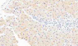 Monoglyceride Lipase Antibody, Novus Biologicals 0.1mg; Unlabeled:Antibodies,