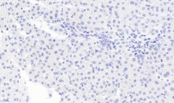 Monoglyceride Lipase Antibody, Novus Biologicals 0.1mg; Unlabeled:Antibodies,