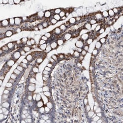 Monoglyceride Lipase Antibody, Novus Biologicals 0.1mL; Unlabeled:Antibodies,