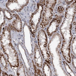 Monoglyceride Lipase Antibody, Novus Biologicals 0.1mL; Unlabeled:Antibodies,