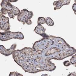Monoglyceride Lipase Antibody, Novus Biologicals 0.1mL; Unlabeled:Antibodies,