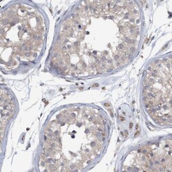 Monoglyceride Lipase Antibody, Novus Biologicals 0.1mL; Unlabeled:Antibodies,