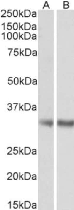 Monoglyceride Lipase Antibody, Novus Biologicals 0.1mg; Unlabeled:Antibodies,