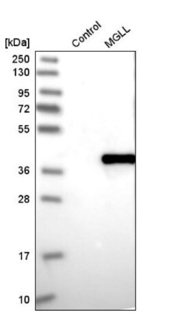 Monoglyceride Lipase Antibody, Novus Biologicals 0.1mL; Unlabeled:Antibodies,