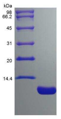Novus Biologicals Recombinant Mouse CCL17/TARC Protein 1 mg | Buy Online | Novus Biologicals&trade; | Fisher Scientific