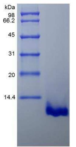 Novus Biologicals Recombinant Mouse CCL22/MDC Protein 1mg | Buy Online | Novus Biologicals&trade; | Fisher Scientific