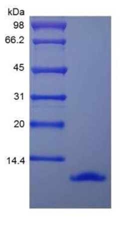 Novus Biologicals Recombinant Mouse CCL3/MIP-1 alpha Protein 10 &mu;g | Buy Online | Novus Biologicals&trade; | Fisher Scientific