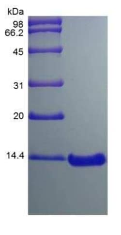 Novus Biologicals Recombinant Mouse CCL7/MCP-3/MARC Protein 10 &mu;g | Buy Online | Novus Biologicals&trade; | Fisher Scientific