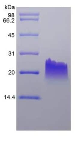 Novus Biologicals Recombinant Mouse CXCL9/MIG Protein 1mg | Buy Online | Novus Biologicals&trade; | Fisher Scientific