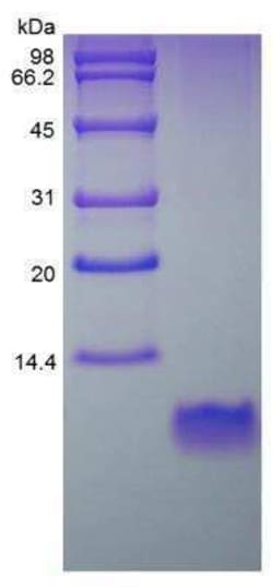 Novus Biologicals Recombinant Mouse Defensin beta 2 Protein 5 &mu;g | Buy Online | Novus Biologicals&trade; | Fisher Scientific