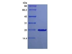 Novus Biologicals Recombinant Mouse Desert Hedgehog C23II Protein 1mg | Buy Online | Novus Biologicals&trade; | Fisher Scientific