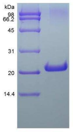 Novus Biologicals Recombinant Mouse FGF-21 Protein 5 &mu;g | Buy Online | Novus Biologicals&trade; | Fisher Scientific