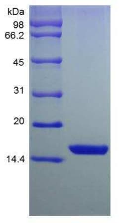 Novus Biologicals Recombinant Mouse FGF acidic/FGF1 Protein 100 &mu;g | Buy Online | Novus Biologicals&trade; | Fisher Scientific