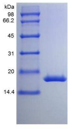 Novus Biologicals Recombinant Mouse G-CSF Protein 100 &mu;g | Buy Online | Novus Biologicals&trade; | Fisher Scientific