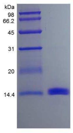 Novus Biologicals Recombinant Mouse GM-CSF Protein 5 &mu;g | Buy Online | Novus Biologicals&trade; | Fisher Scientific