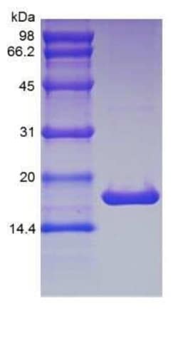 Novus Biologicals Recombinant Mouse IL-1 beta/IL-1F2 Protein 1mg | Buy Online | Novus Biologicals&trade; | Fisher Scientific