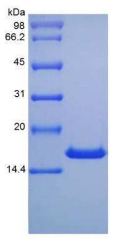Novus Biologicals Recombinant Mouse IL-10 Protein 10 &mu;g | Buy Online | Novus Biologicals&trade; | Fisher Scientific