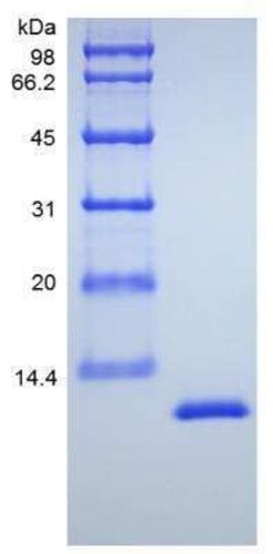 Novus Biologicals Recombinant Mouse IL-13 Protein 10 &mu;g | Buy Online | Novus Biologicals&trade; | Fisher Scientific