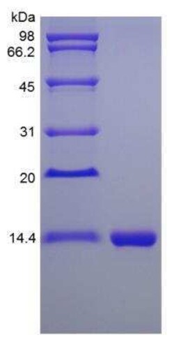 Novus Biologicals Recombinant Mouse IL-16 Protein 10 &mu;g | Buy Online | Novus Biologicals&trade; | Fisher Scientific