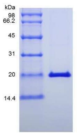 Novus Biologicals Recombinant Mouse IL-28A/IFN-lambda 2 Protein 5 &mu;g | Buy Online | Novus Biologicals&trade; | Fisher Scientific