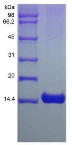 Novus Biologicals Recombinant Mouse IL-3 Protein 10 &mu;g | Buy Online | Novus Biologicals&trade; | Fisher Scientific