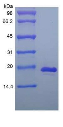 Novus Biologicals Recombinant Mouse IL-33 Protein 500 &mu;g | Buy Online | Novus Biologicals&trade; | Fisher Scientific