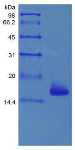 Novus Biologicals Recombinant Mouse IL-36 alpha/IL-1F6 Protein 1mg | Buy Online | Novus Biologicals&trade; | Fisher Scientific