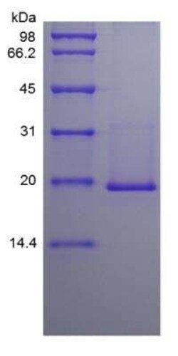 Novus Biologicals Recombinant Mouse IL-36 beta/IL-1F8 Protein 10 &mu;g | Buy Online | Novus Biologicals&trade; | Fisher Scientific