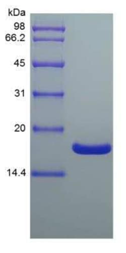Novus Biologicals Recombinant Mouse IL-36 gamma/IL-1F9 Protein 0.01 mg | Buy Online | Novus Biologicals&trade; | Fisher Scientific