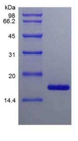 Novus Biologicals Recombinant Mouse Midkine Protein 1mg | Buy Online | Novus Biologicals&trade; | Fisher Scientific