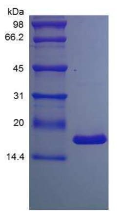 Novus Biologicals Recombinant Mouse TNF-alpha Protein 1mg | Buy Online | Novus Biologicals&trade; | Fisher Scientific