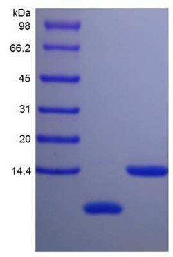 Novus Biologicals Recombinant Mouse Uteroglobin/SCGB1A1 Protein 1mg | Buy Online | Novus Biologicals&trade; | Fisher Scientific