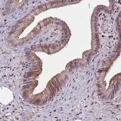 Mrc2 Antibody, Novus Biologicals:Antibodies:Primary Antibodies