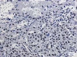 Mre11 Rabbit anti-Human, Mouse, Rat, Clone: S03-6H9, Novus Biologicals