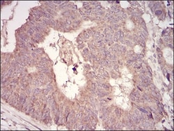 MuRF1/TRIM63 Antibody (7B8E1) - BSA Free, Novus Biologicals 0.1mg; Unlabeled:Antibodies,