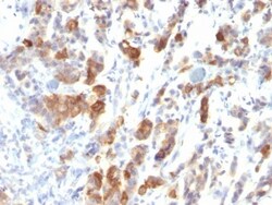 MUC5AC Antibody (MUC5AC/917), Novus Biologicals 0.2mg; Unlabeled:Antibodies,