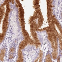 MUC5AC Antibody, Novus Biologicals:Antibodies:Primary Antibodies
