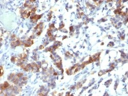 MUC5AC Antibody (MUC5AC/917 + 45M1), Novus Biologicals 0.2mg; Unlabeled:Antibodies,