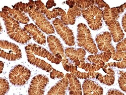MUC5AC Antibody (MUC5AC/917 + 45M1), Novus Biologicals 0.2mg; Unlabeled:Antibodies,