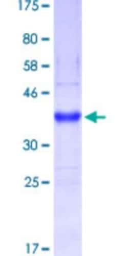 Novus Biologicals&trade;&nbsp;Recombinant Human MUC5B GST (N-Term) Protein