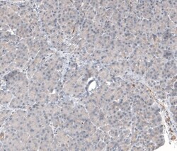 Mucolipin 1 Antibody, Novus Biologicals 0.1mL; Unlabeled:Antibodies, Polyclonal
