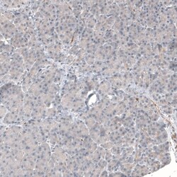 Mucolipin 1 Antibody, Novus Biologicals 0.1mL; Unlabeled:Antibodies, Polyclonal