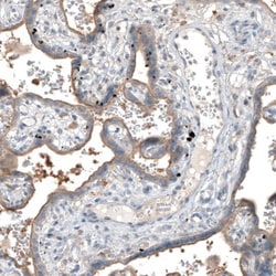 Mucolipin 1 Antibody, Novus Biologicals 0.1mL; Unlabeled:Antibodies, Polyclonal