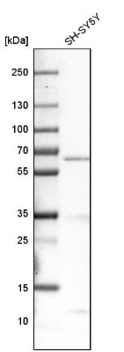 Mucolipin 1 Antibody, Novus Biologicals 0.1mL; Unlabeled:Antibodies, Polyclonal